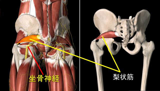 梨状筋