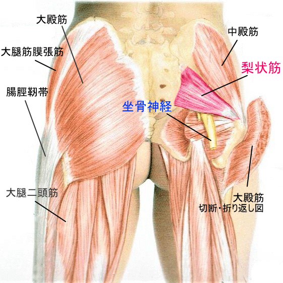 梨状筋解剖図